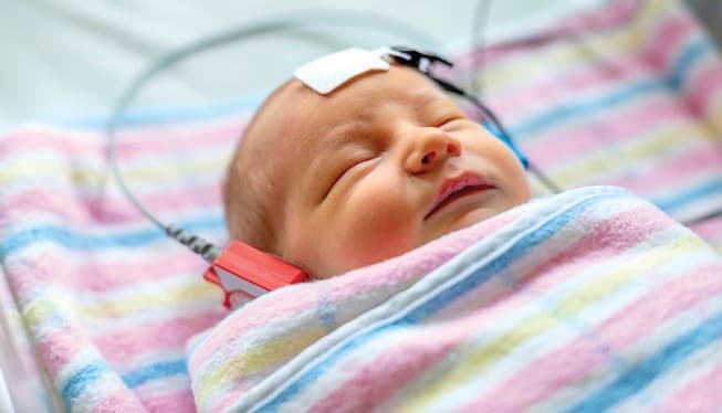 اختبار الاستجابة السمعية المستقرة (ASSR)