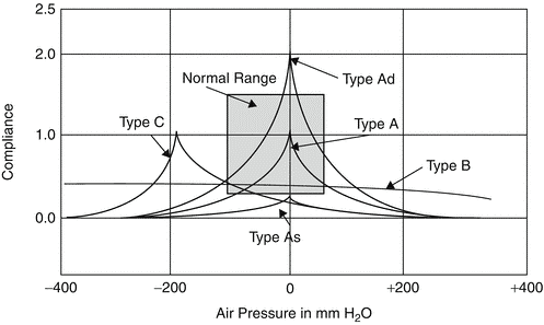 أنماط نتائج اختبار المعاوقة السمعية Tympanogram مثل Type A وType As وType B وType C
